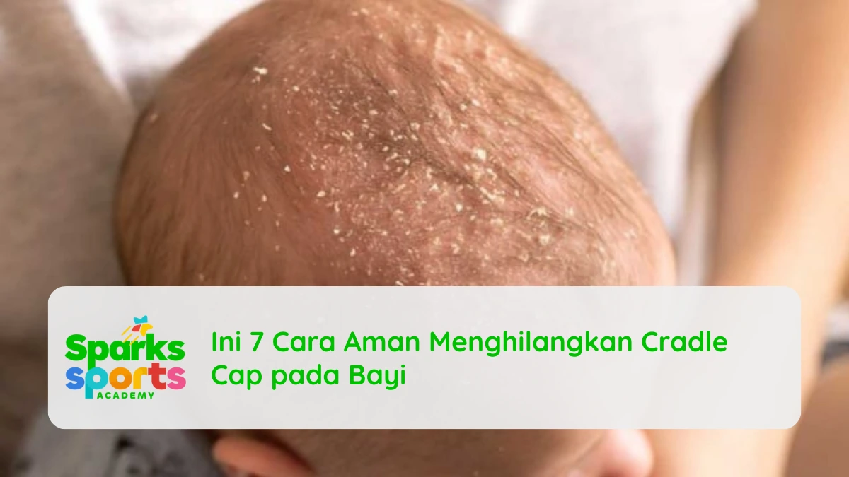 Ini 7 Cara Aman Menghilangkan Cradle Cap pada Bayi